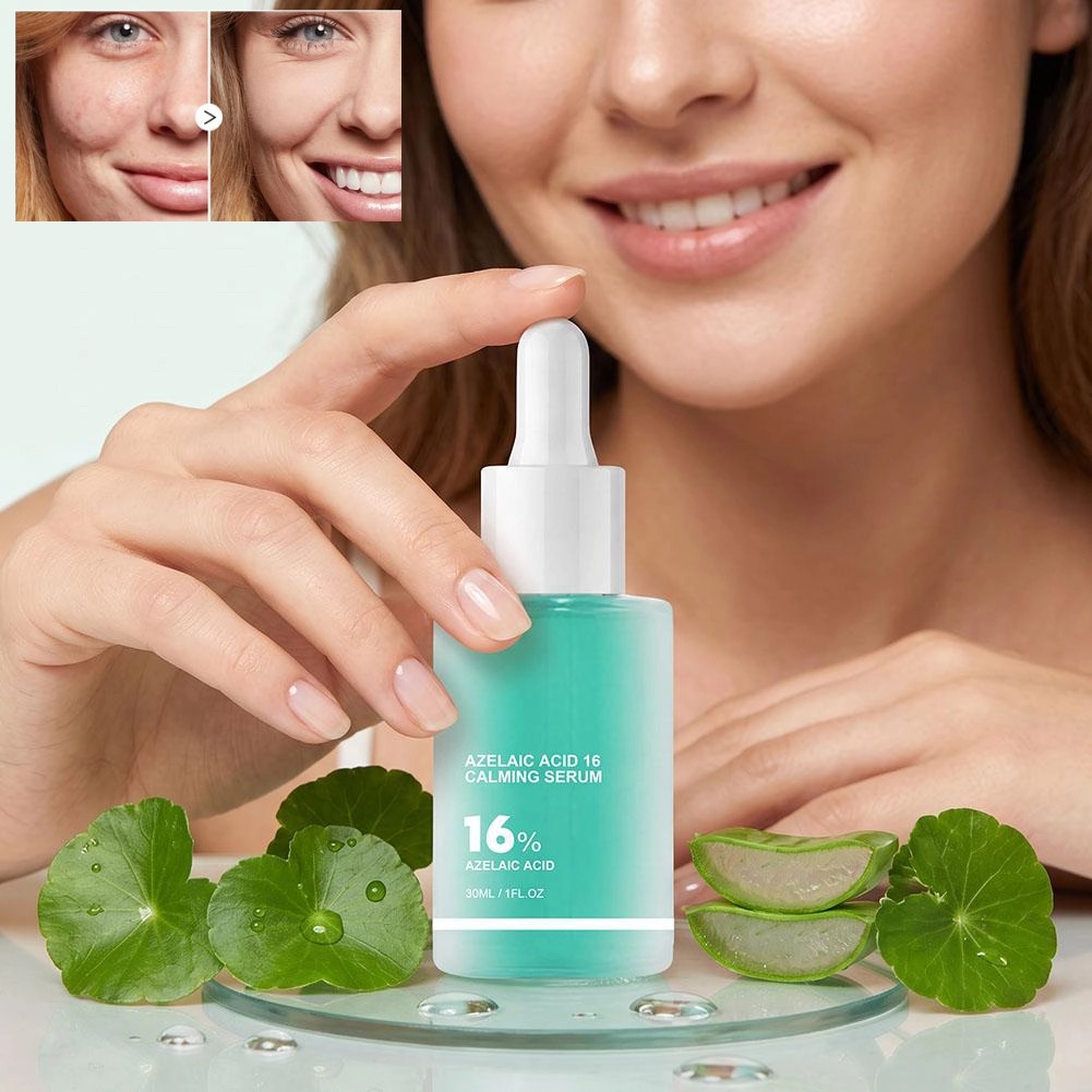 Azelaic Acid Serum - Azelaic Acid Calming Serum 30ml,Even Skin