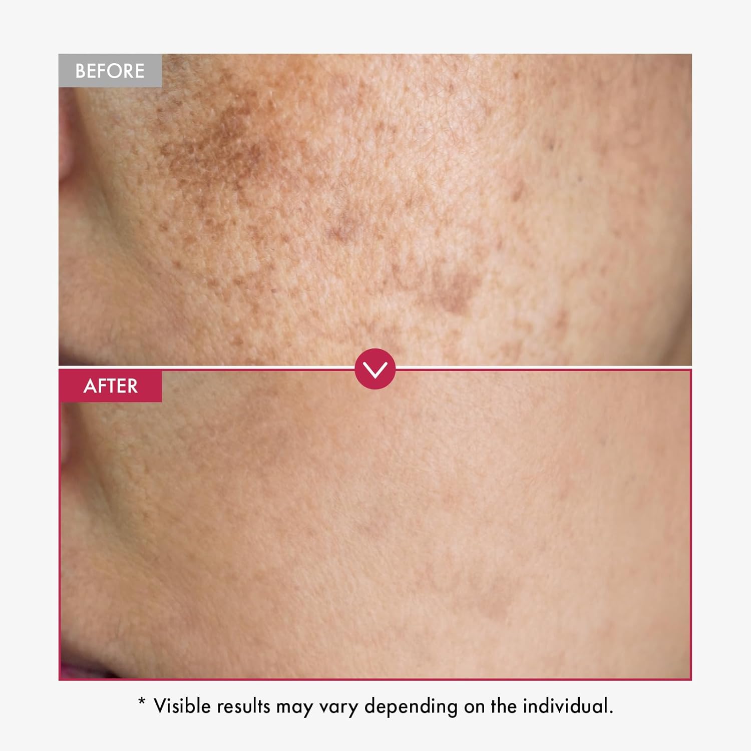 Alpha Arbutin Serum AHA Keeps  - Alpha Arbutin Serum review and price