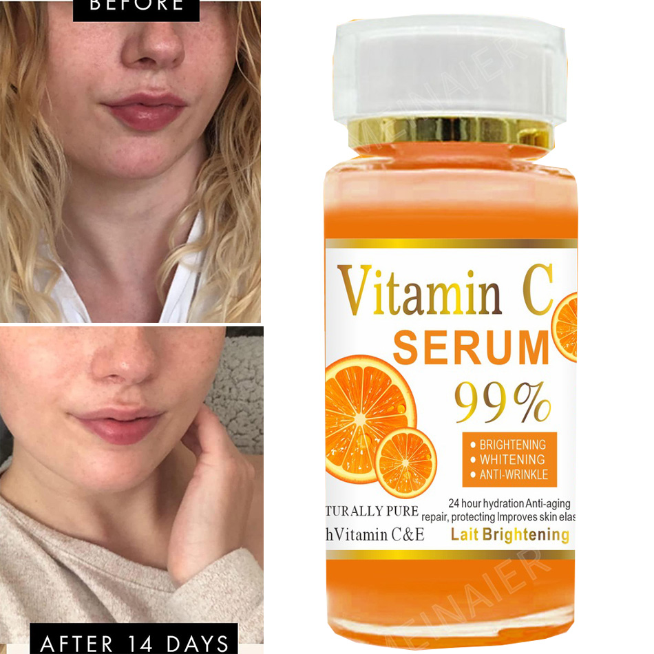 120ml 99% Vitamin C Serum Oil  - Alpha Arbutin Serum review and price