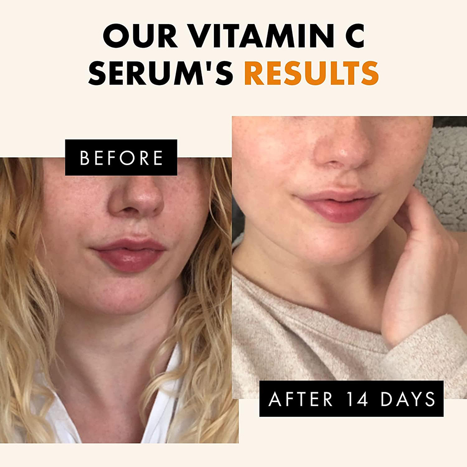 120ml 99% Vitamin C Serum Oil  - Alpha Arbutin Serum review and price