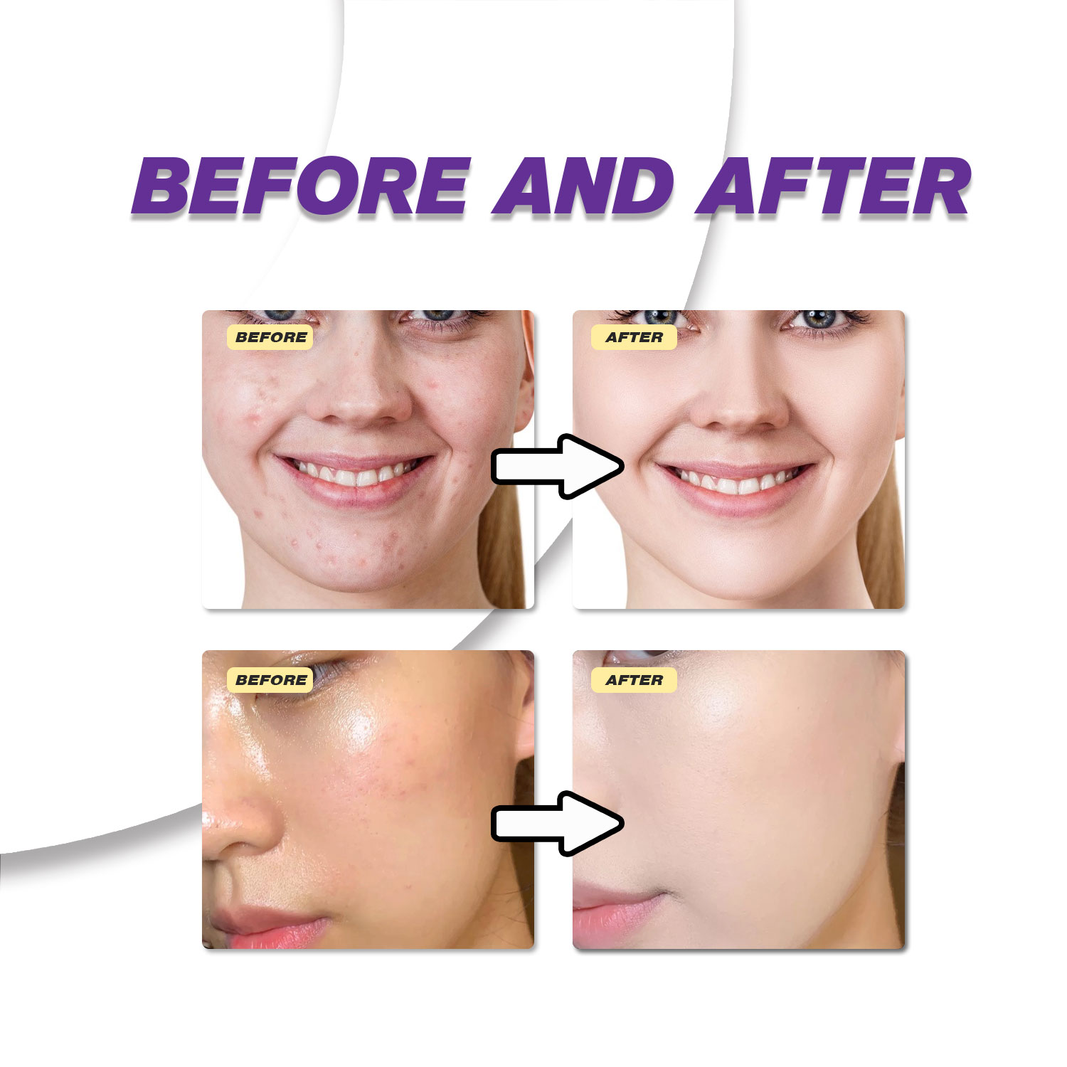 Mild Azelaic Acid Cream Improv - Azelaic Acid Serum review and price