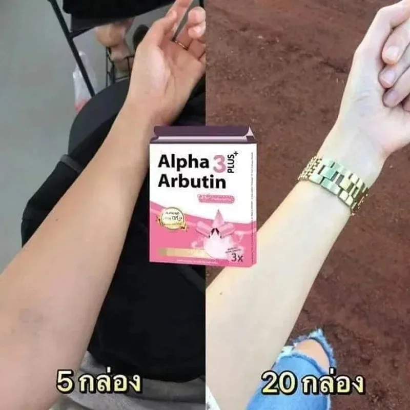 Alpha Arbutin 3 Plus Powder Mi - Alpha Arbutin Serum review and price